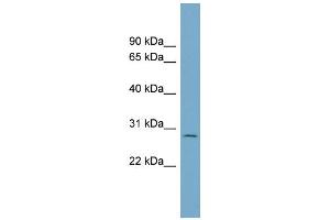 WB Suggested Anti-C1orf96 Antibody Titration: 0. (CCSAP Antikörper  (N-Term))