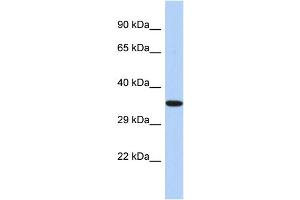 Western Blotting (WB) image for anti-Epoxide Hydrolase 4 (EPHX4) (C-Term) antibody (ABIN2786305) (EPHX4 Antikörper  (C-Term))
