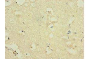 Immunohistochemistry of paraffin-embedded human brain tissue using ABIN7161009 at dilution of 1:100 (NOX3 Antikörper  (AA 223-395))