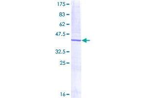 Dual Specificity Phosphatase 3 (DUSP3) (AA 1-144) protein (GST tag)