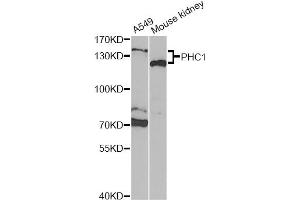 Western blot analysis of extracts of various cell lines, using PHC1 Antibody (ABIN2564499) at 1:1000 dilution. (PHC1 Antikörper)