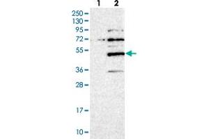 Western blot analysis of Lane 1: Negative control (vector only transfected HEK293T lysate), Lane 2: Over-expression Lysate (Co-expressed with a C-terminal myc-DDK tag (~3. (SERTAD4 Antikörper)