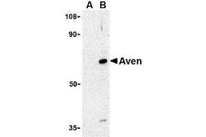 Western blot analysis of Aven in Raji cell lysate with AP30099PU-N Aven antibody at 1 μg/ml in (A) the presence and (B) the absence of blocking peptide.