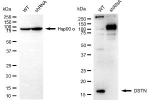 Western blotting analysis using DSTN antibody (ABIN7798322).