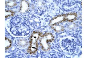 Immunohistochemistry (IHC) image for anti-serpin Peptidase Inhibitor, Clade F (Alpha-2 Antiplasmin, Pigment Epithelium Derived Factor), Member 1 (SERPINF1) (N-Term) antibody (ABIN2792309)