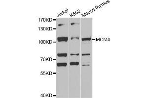 Western blot analysis of extracts of various cell lines, using MCM4 antibody (ABIN5971548) at 1:400 dilution. (MCM4 Antikörper)