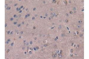 DAB staining on IHC-P; Samples: Mouse Cerebrum Tissue (M-CSF/CSF1 Antikörper  (AA 33-204))