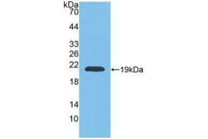 Western blot analysis of recombinant Rat MMP9. (MMP 9 Antikörper  (AA 226-391))