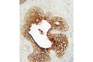 Immunohistochemistry (IHC) image for anti-Lymphocyte-Activation Gene 3 (LAG3) antibody (ABIN3002914)