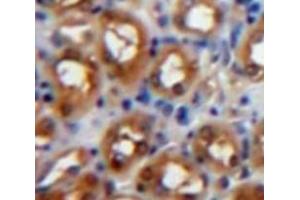 Used in DAB staining on fromalin fixed paraffin-embedded Kidney tissue (PKC zeta Antikörper  (AA 254-484))