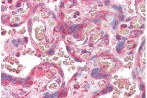Anti-ERV3 antibody IHC staining of human placenta. (ERV3 Antikörper  (AA 313-323))