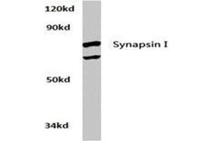 Western blot analysis of Synapsin-1 Antibody  in extracts from Hela cells at 1/500 dilution. (SYN1 Antikörper)