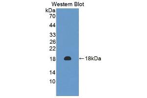 Western blot analysis of the recombinant protein. (Peroxiredoxin 2 Antikörper  (AA 6-164))