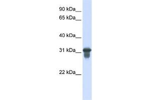 WB Suggested Anti-SLC25A11 Antibody Titration:  0. (SLC25A11 Antikörper  (C-Term))