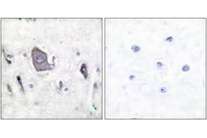 Immunohistochemistry analysis of paraffin-embedded human brain, using Trk B (Phospho-Tyr705) Antibody. (TRKB Antikörper  (pTyr706))