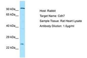Image no. 1 for anti-Cadherin 7 (CDH7) (AA 51-100) antibody (ABIN6749910) (Cadherin 7 Antikörper  (AA 51-100))