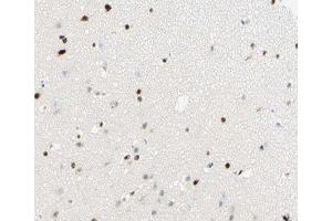 ABIN6266815 at 1/100 staining human brain tissue sections by IHC-P. (THRB Antikörper  (Internal Region))