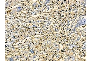 anti-Endoplasmic Reticulum Protein 44 (ERP44) antibody
