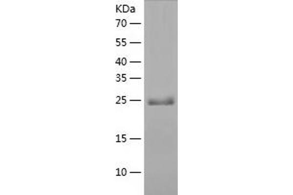 MYL6B Protein (AA 1-208) (His tag)