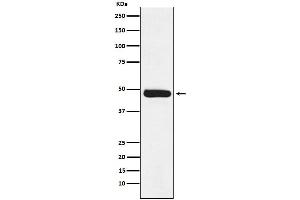 Western blot analysis of ERCC8 expression in Molt4 cell lysate.