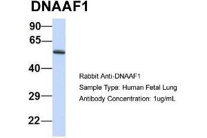 Host: Rabbit  Target Name: DNAAF1  Sample Tissue: Human Fetal Lung  Antibody Dilution: 1. (LRRC50 Antikörper  (N-Term))