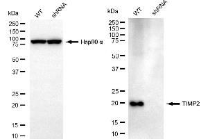 Western blotting analysis using TIMP2 antibody (ABIN7799377). (TIMP2 Antikörper)