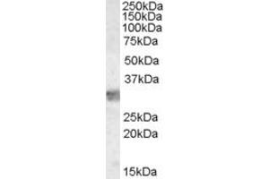 Western Blotting (WB) image for anti-Myeloid Differentiation Primary Response Gene (88) (MYD88) (Internal Region) antibody (ABIN2465254) (MYD88 Antikörper  (Internal Region))