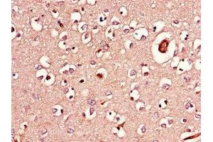 Immunohistochemistry of paraffin-embedded human brain tissue using ABIN7143254 at dilution of 1:100 (Acylglycerol Kinase Antikörper  (AA 32-65))