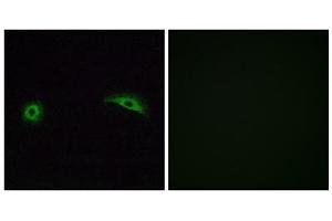Immunofluorescence analysis of A549 cells, using OR2J2 antibody. (OR2J2 Antikörper  (C-Term))