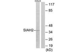 Western blot analysis of extracts from COLO cells, using SIAH2 Antibody. (SIAH2 Antikörper  (AA 241-290))