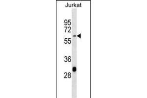 TN3 Antibody (Center) (ABIN656882 and ABIN2846082) western blot analysis in Jurkat cell line lysates (35 μg/lane). (Matrilin 3 Antikörper  (AA 220-248))