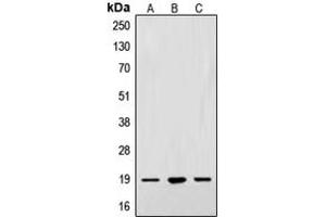Western blot analysis of Alpha-synuclein expression in A549 (A), SKNSH (B), PC12 (C) whole cell lysates. (SNCA Antikörper  (N-Term))