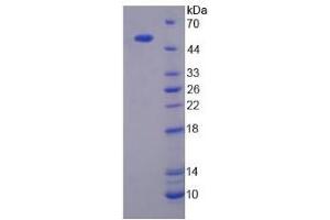 Image no. 1 for Mannan-Binding Lectin Serine Peptidase 1 (MASP1) (AA 25-453) protein (His tag) (ABIN4988920) (MASP1 Protein (AA 25-453) (His tag))
