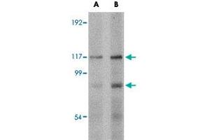 Western blot analysis of FNIP2 in rat skeletal muscle tissue lysate with FNIP2 polyclonal antibody  at (A) 1 and (B) 2 ug/mL . (FNIP2 Antikörper  (C-Term))