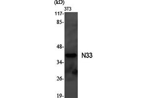 Western Blotting (WB) image for anti-Tumor Suppressor Candidate 3 (TUSC3) antibody (ABIN5961746) (TUSC3 Antikörper)