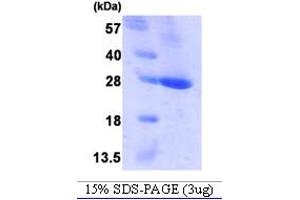 SDS-PAGE (SDS) image for B-Cell CLL/lymphoma 2 (BCL2) (AA 1-211) protein (His tag) (ABIN667734) (Bcl-2 Protein (AA 1-211) (His tag))