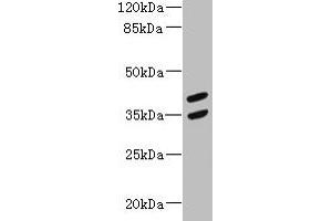Western blot All lanes: MAGEB10 antibody at 12 μg/mL + Mouse heart tissue Secondary Goat polyclonal to rabbit IgG at 1/10000 dilution Predicted band size: 39 kDa Observed band size: 39, 35 kDa (MAGEB1 Antikörper  (AA 1-300))