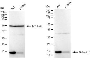 Western blotting analysis using Galectin 1 antibody (ABIN7799243).