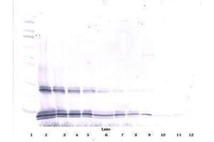Image no. 1 for anti-Interleukin 15 (IL15) antibody (ABIN465267) (IL-15 Antikörper)