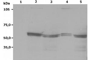 Western Blotting analysis (non-reducing conditions) of Lyn using anti-Lyn (LYN-01). (LYN Antikörper  (AA 8-238))