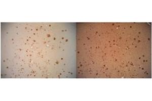 Immunohitsochemistry analysis of Amyloid Fibrils (OC) in Human AD brain, showing no Amyloid Precursor Protein (APP) cross-reactivity (Left), but when conducted with monoclonal 6E10 (Right) shows considerable APP cross-reactivity. (Amyloid Fibrils Antikörper)