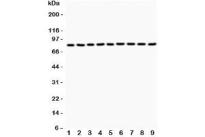 Western blot testing of Plakoglobin antibody and Lane 1:  rat brain;  2: (r) heart;  3: (r) thymus;  4: (r) RH35;  5: human HeLa;  6: (h) COLO320;  7: (h) HepG2;  8: mouse HepA;  9: (h) MCF-7. (JUP Antikörper  (AA 556-745))
