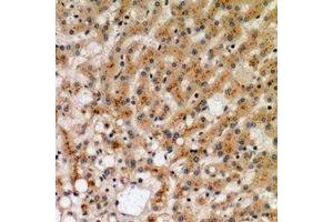 Immunohistochemical analysis of CD265 staining in human liver formalin fixed paraffin embedded tissue section. (TNFRSF11A Antikörper  (N-Term))