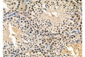 ABIN6258658 and ABIN6274958 at 1/100 staining Mouse testis tissue by IHC-P. (CA13 Antikörper  (Internal Region))