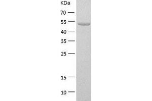 Western Blotting (WB) image for Guanine Deaminase (GDA) (AA 1-454) protein (His-IF2DI Tag) (ABIN7123235)