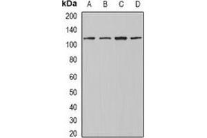 Western blot analysis of INTS4 expression in Jurkat (A), A549 (B), mouse testis (C), mouse heart (D) whole cell lysates. (INTS4 Antikörper)