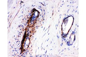 Anti-LASP1 antibody,  IHC(P) IHC(P): Human Placenta Tissue (LASP1 Antikörper  (N-Term))