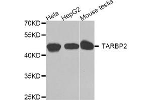 Western blot analysis of extracts of various cell lines, using TARBP2 antibody (ABIN5974736) at 1/1000 dilution. (TARBP2 Antikörper)