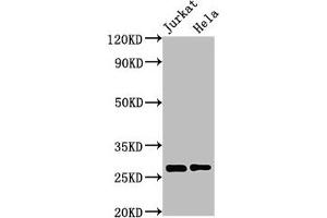 Western Blot Positive WB detected in: Jurkat whole cell lysate, Hela whole cell lysate All lanes: HSD17B10 antibody at 3 μg/mL Secondary Goat polyclonal to rabbit IgG at 1/50000 dilution Predicted band size: 27, 26 kDa Observed band size: 27 kDa (HSD17B1 Antikörper  (AA 2-261))