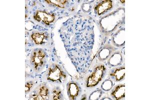 Immunohistochemistry of paraffin-embedded human kidney using [KO Validated]  Rabbit mAb  at dilution of 1:100 (40x lens). (ACE2 Antikörper)